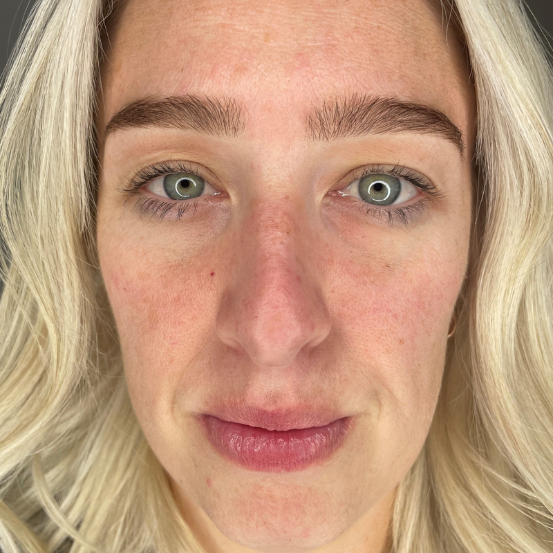 Skin clarity & tone