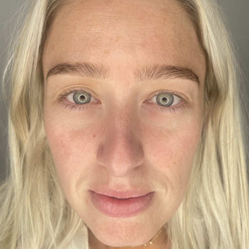 Skin clarity & tone